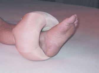 DermaSaver Relevator Heel Elevator